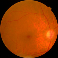 APTOS Example Image
